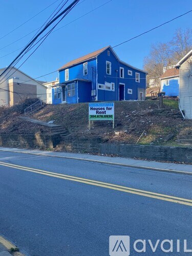 A blue house is for rent and is located on a hill.
