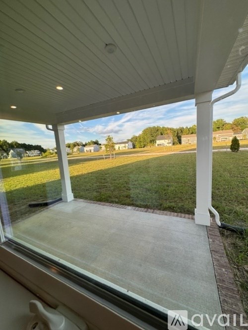 A sunny day at the backyard with a white pergola.