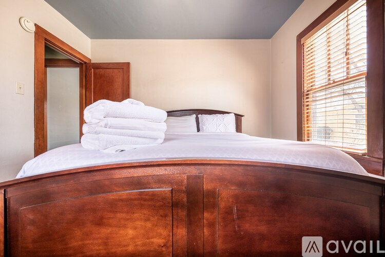 A bed with white towels on top of it.