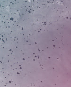 A09